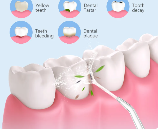 Portable Dental Water Flosser for Teeth Cordless USB Rechargeable Water Jet Floss Tooth Pick 4 Jet Tip 220ml 3 Modes IPX7 1400rpm